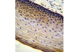 Immunohistochemistry analysis in formalin fixed and paraffin embedded human cervical tissue reacted with LENG9 Antibody (N-term) followed by peroxidase conjugation of the secondary antibody and DAB staining. (LENG9 antibody  (N-Term))