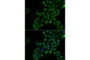 Immunofluorescence analysis of U2OS cells using TSPAN7 antibody. (Tetraspanin 7 antibody)