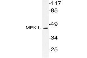 Western blot (WB) analyzes of MEK1 antibody in extracts from Jurkat cells. (MEK1 antibody)