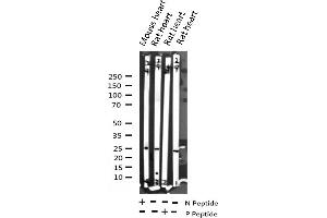 Western blot analysis of Phospho-TNNI3 (Ser43) expression in various lysates (TNNI3 antibody  (pSer44))