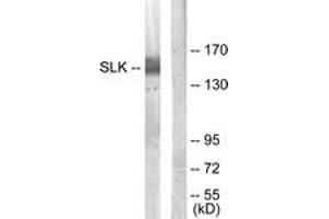 Western blot analysis of extracts from COLO205 cells, using SLK Antibody. (SLK antibody  (AA 1151-1200))