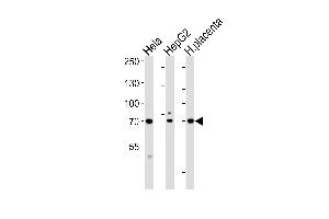 Western blot analysis of lysates from Hela, HepG2 cell line and human placenta tissue lysate (from left to right), using CREBL1Antibody at 1:1000 at each lane.