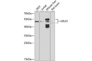 Western blot analysis of extracts of various cell lines, using CRLF2 antibody (ABIN6130231, ABIN6139052, ABIN6139053 and ABIN6214305) at 1:1000 dilution. (CRLF2 antibody  (AA 23-231))