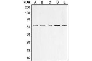 Western blot analysis of p53 expression in A549 (A), HeLa (B), HepG2 (C), MCF7 (D), A431 (E) whole cell lysates. (p53 antibody  (N-Term))