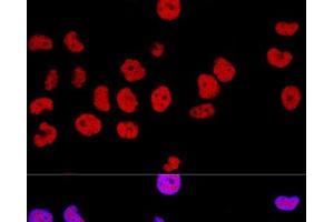 Confocal immunofluorescence analysis of Hela cells using CTCF Polyclonal Antibody at dilution of 1:100. (CTCF antibody)