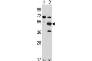 Western Blotting (WB) image for anti-PX domain-containing protein kinase-like protein (PXK) antibody (ABIN2997775) (PXK antibody)