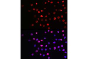 Immunofluorescence analysis of NIH/3T3 cells using Acetyl-Histone H3-K27 Rabbit mAb (ABIN3016650, ABIN3016651, ABIN3016652, ABIN1682513 and ABIN1682514) at dilution of 1:100 (40x lens). (Histone 3 antibody  (acLys27))