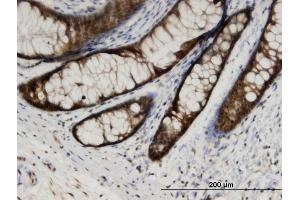 Immunoperoxidase of monoclonal antibody to CMPK1 on formalin-fixed paraffin-embedded human colon. (Cytidine Monophosphate (UMP-CMP) Kinase 1, Cytosolic (CMPK1) (AA 1-228) antibody)