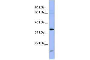 WB Suggested Anti-PYCR1 Antibody Titration: 0. (PYCR1 antibody  (Middle Region))