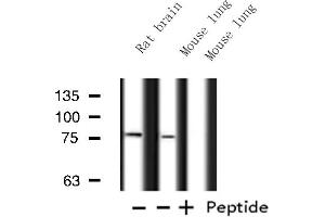 Western blot analysis of ATXN7L2 expression in various lysates (ATXN7L2 antibody  (Internal Region))