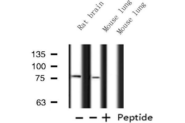 ATXN7L2 antibody  (Internal Region)