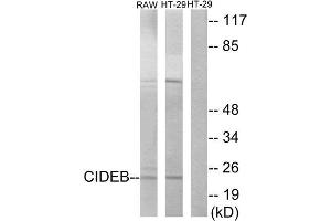 Western Blotting (WB) image for anti-Cell Death-Inducing DFFA-Like Effector B (CIDEB) (Internal Region) antibody (ABIN1850416) (CIDEB antibody  (Internal Region))