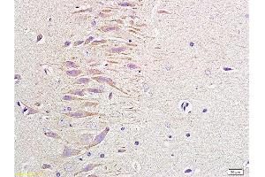 Formalin-fixed and paraffin embedded rat brain labeled with Anti-NPY/Neuropeptide Y Polyclonal Antibody, Unconjugated 1:400 followed by conjugation to the secondary antibody and DAB staining (NPY antibody  (AA 29-64))