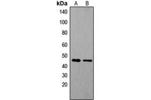 Western blot analysis of Tachykinin Receptor 1 expression in COLO205 (A), mouse brain (B) whole cell lysates. (TACR1 antibody  (Center))
