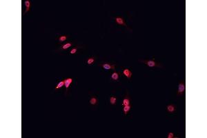 Immunofluorescence (fixed cells) (IF/ICC) image for anti-Transcription Factor Dp-1 (TFDP1) (C-Term) antibody (ABIN6265535)