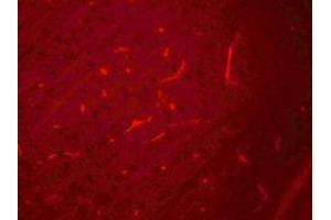 Immunofluorescence of SIK3 in rat brain cells with SIK3 antibody at 20 ug/mL. (SIK3 antibody  (C-Term))