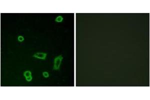 Immunofluorescence analysis of LOVO cells, using MTR1L Antibody. (GPR50 antibody  (AA 301-350))