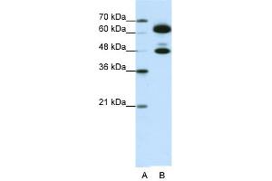 WB Suggested Anti-SNRP70 Antibody Titration:  0. (SNRNP70 antibody  (C-Term))