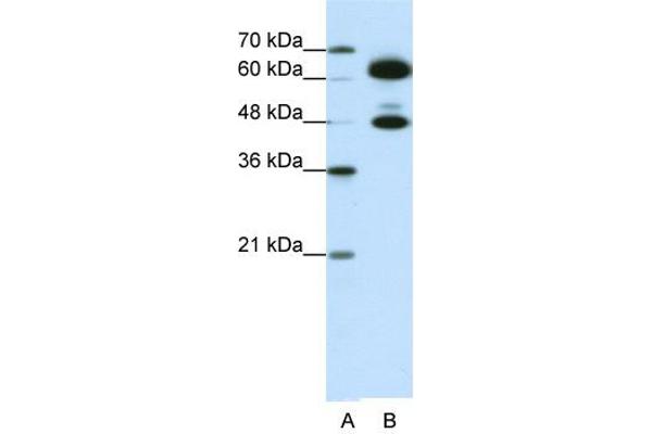SNRNP70 antibody  (C-Term)
