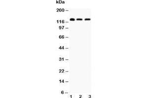Western blot testing of SIRT1 antibody and Lane 1:  HEPG2;  2: MCF;  3: SW620. (SIRT1 antibody  (AA 112-311))