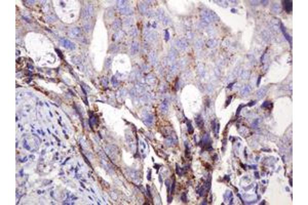 ITFG3 antibody