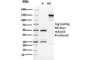 SDS-PAGE (SDS) image for anti-Keratin 5 (KRT5) (AA 316-590) antibody (ABIN6939864)