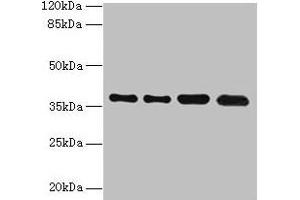 Western blot All lanes: TMEM19 antibody at 1 μg/mL Lane 1: MCF-7 whole cell lysate Lane 2: U251 whole cell lysate Lane 3: Mouse stomach tissue Lane 4: A549 whole cell lysate Secondary Goat polyclonal to rabbit IgG at 1/10000 dilution Predicted band size: 37, 33 kDa Observed band size: 37 kDa (TMEM19 antibody  (AA 105-217))