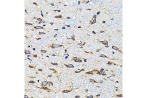 Immunohistochemistry of paraffin-embedded mouse spinal cord using CDK1 antibody. (CDK1 antibody  (AA 208-258))