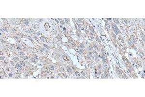 Immunohistochemistry (Paraffin-embedded Sections) (IHC (p)) image for anti-Sodium Channel, Nonvoltage-Gated 1, gamma (SCNN1G) antibody (ABIN7245647)