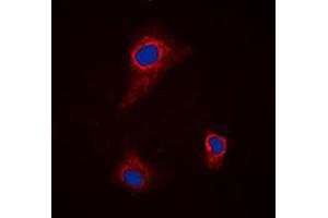 Immunofluorescent analysis of SLC43A1 staining in H9C2 cells. (SLC43A1 antibody  (Center))
