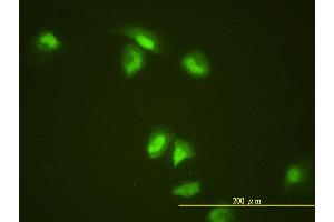 Immunofluorescence of monoclonal antibody to SLBP on HeLa cell. (SLBP antibody  (AA 1-270))