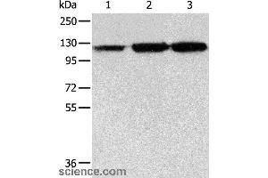 Western blot analysis of PC3 cell, human colon cancer and liver cancer tissue, using HSPH1 Polyclonal Antibody at dilution of 1:500 (HSPH1 antibody)
