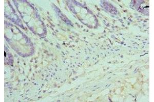 Immunohistochemistry of paraffin-embedded human colon tissue using ABIN7172504 at dilution of 1:100 (DP1 antibody  (AA 1-290))