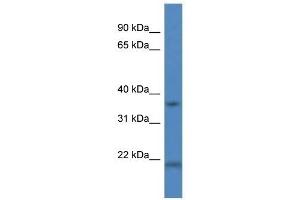 Western Blot showing CTSK antibody used at a concentration of 1 ug/ml against Fetal Liver Lysate