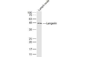 Mouse Lymph node lysates probed with Langerin Polyclonal Antibody, Unconjugated  at 1:300 dilution and 4˚C overnight incubation.