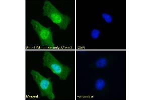 ABIN6391400 Immunofluorescence analysis of paraformaldehyde fixed HeLa cells, permeabilized with 0. (LMO3 antibody  (C-Term))