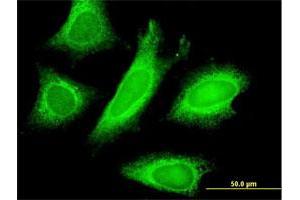 Immunofluorescence of monoclonal antibody to STAU1 on HeLa cell. (STAU1/Staufen antibody  (AA 401-496))