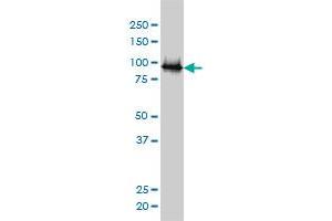 UBE3A monoclonal antibody (M01), clone 2F6 Western Blot analysis of UBE3A expression in Jurkat (ABIN1339540). (ube3a antibody  (AA 51-150))