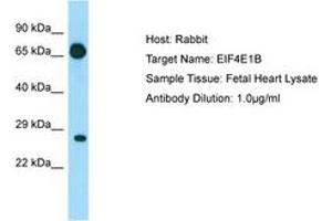Image no. 1 for anti-Eukaryotic Translation Initiation Factor 4E Family Member 1B (EIF4E1B) (AA 20-69) antibody (ABIN6749877)