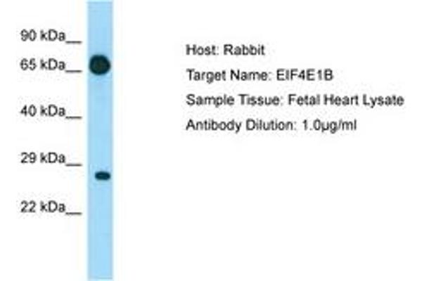 EIF4E1B Antikörper  (AA 20-69)
