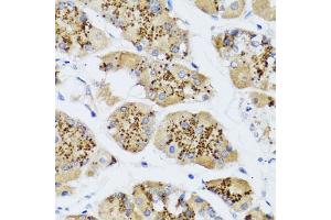 Immunohistochemistry of paraffin-embedded human stomach using CHIC2 antibody (ABIN5974773) at dilution of 1/100 (40x lens). (CHIC2 antibody)