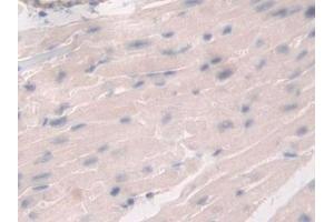 Immunohistochemistry (IHC) image for anti-DEAD (Asp-Glu-Ala-Asp) Box Polypeptide 58 (DDX58) (AA 1-211) antibody (ABIN7440305)