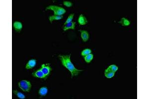 Immunofluorescent analysis of MCF-7 cells using ABIN7149644 at dilution of 1:100 and Alexa Fluor 488-congugated AffiniPure Goat Anti-Rabbit IgG(H+L) (GRID2IP antibody  (AA 35-156))