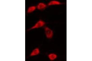 ABIN6276303 staining  Hela cells by IF/ICC. (DDIT3 antibody  (N-Term))