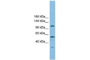 CHTF18 antibody used at 1 ug/ml to detect target protein. (CTF18 antibody)