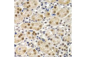 Immunohistochemistry of paraffin-embedded mouse kidney using ID3 antibody at dilution of 1:200 (400x lens). (ID3 antibody)