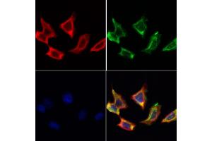 ABIN6259603 and ABIN6274618 staining Hela cells by IF/ICC.