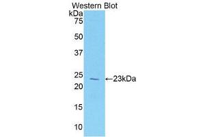 Western Blotting (WB) image for anti-Vitamin D-Binding Protein (GC) (AA 18-211) antibody (ABIN1078666) (Vitamin D-Binding Protein antibody  (AA 18-211))