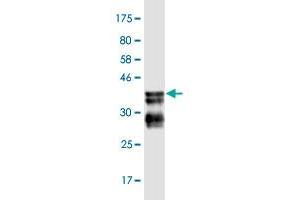 Western Blot detection against Immunogen (36. (BCL9 antibody  (AA 1036-1135))