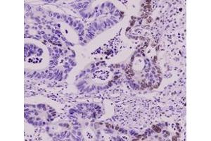 Immunohistochemistry (IHC) image for anti-Small Ubiquitin Related Modifier 2 (SUMO2) (AA 1-93), (N-Term) antibody (ABIN492386) (SUMO2 antibody  (N-Term))